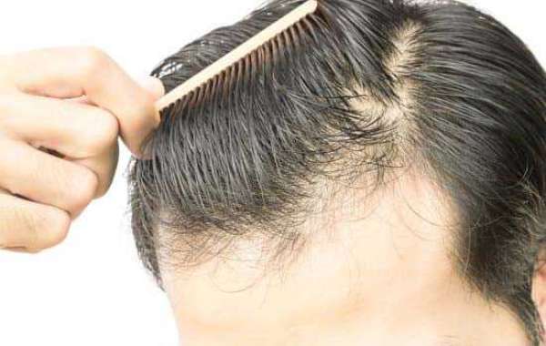Preventing hair loss